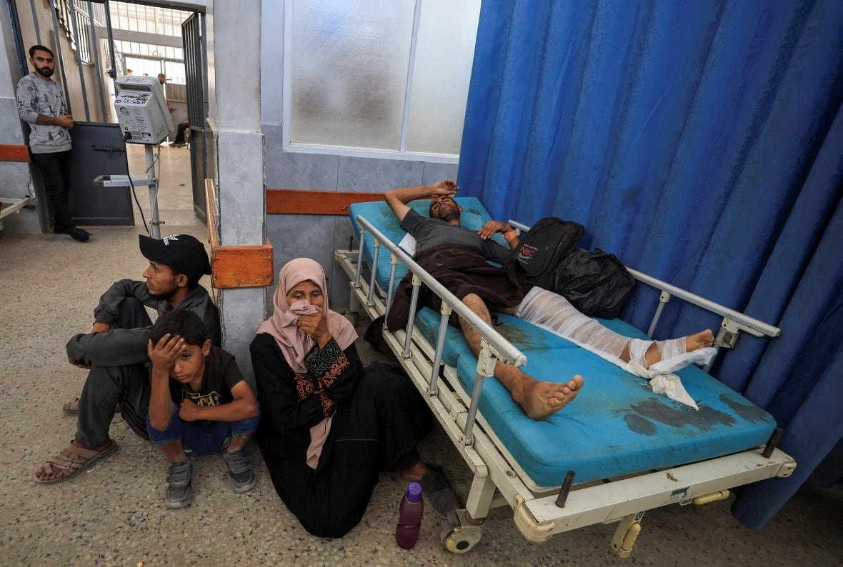 israel-palestinians-gaza-13 A family sits next to an injured man in the hospital.