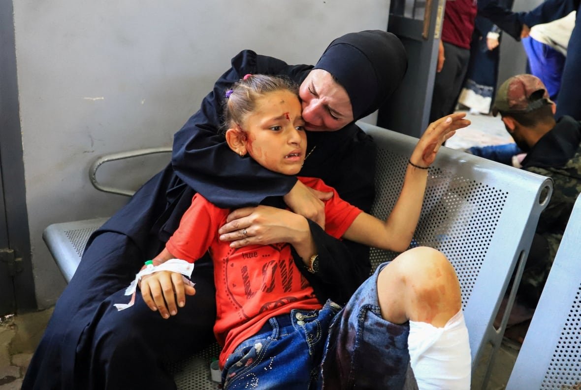israel-palestinians-gaza-14 A Palestinian girl, wounded in an Israeli strike, lays in the arms of a woman.