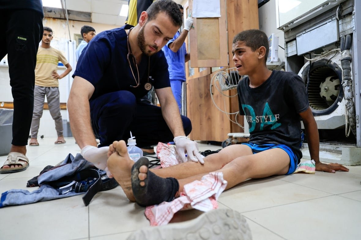 israel-palestinians-gaza A boy sits on the floor crying as a doctor looks at his leg